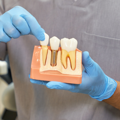 Restorative Care at Bella Sonrisa Dental