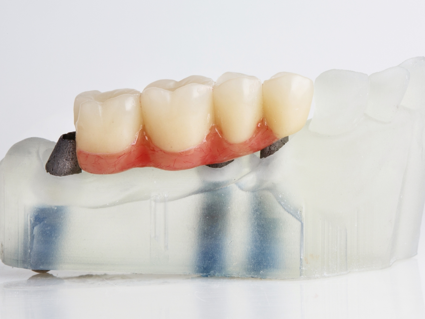 Dental Services